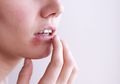 Sariawan Tak Kunjung Sembuh? Hati-Hati Terkena Herpes Genital! Ini Tandanya