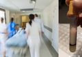 Darah Berubah Menggumpal dan Terancam Mati, Kondisi Pasien Ini Disebabkan Kebiasan Buruk, Salah Satunya Merokok