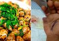 Jangan Sembarangan Makan Seafood, Kaki 2 Wanita Ini Tiba-tiba Bengkak dan Meninggal Sehari Setelah Dirawat