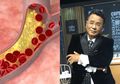 Hotman Paris Pernah Divonis Penyakit Mematikan, 5 Makanan Enak Ini Bisa Jadi Pemicunya