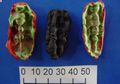 Permen Karet Ini Menyimpan DNA Manusia Purba dari 10 Ribu Tahun Lalu