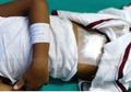 Saat Dokter yang Seharusnya Mengoperasi Hidung Malah Mengoperasi Perut Pasien, Ternyata Ini Penyebabnya