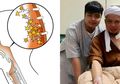 Hati-hati, Kebiasaan Memasak dengan Asap Bisa Jadi Pemicu Kanker Nasofaring Seperti yang Diidap Ustad Arifin Ilham