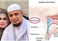 Gejala Awal Kanker Nasofaring Selain Telinga Berdengung Adalah Hidung Tersumbat, Seperti yang Diderita Almarhum Ustaz Arifin Ilham