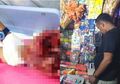 Gara-Gara Petasan Meledak di Tangan, Bocah Ini Kehilangan 5 Jarinya Sekaligus