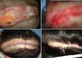 Mewarnai Rambut di Salon, Wanita Ini Bukannya Jadi Seperti Artis Idola, Kepalanya Mengalami Luka Bakar Menganga Panjang dan Lebar