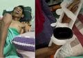 Tahu Kelemahan Buaya, Seorang Pria Lolos dari Terkaman Buaya, Tapi Kondisinya Tetap Memilukan Seperti Ini