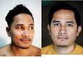 Pembuluh Darah Mata Aktor Tampan Pecah Karena Keseringan Main Ponsel, Ini Reaksi Mata Saat Terlalu Lama Tatap Layar Ponsel
