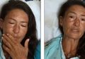 Berurai Air Mata, Wanita Ini Ceritakan Kisahnya Hilang di Hutan Selama 2 Minggu Sampai Harus Makan Ngengat dan Tidur di Sarang Babi
