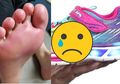 Gunakan Sepatu dengan Lampu yang Menyala, Seorang Anak Alami Kejadian Nahas Hingga Trauma