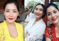 Vakum Selama 7 Tahun, Lulu Tobing Ceritakan Cara Mengatasi Masalah Kulitnya