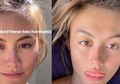 Wajah Agnez Mo Dianggap Terlalu Tirus, Begini Cara Alami Untuk Mengecilkan Pipi