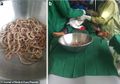 Mengeluh Sering Sakit Perut dan Sembelit Selama 6 Bulan Dokter Temukan Setumpuk Cacing Menyumbat Usus Bocah 4 Tahun