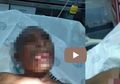 Niat Memperkosa Dokter Muda, Pria ini Justru Alami Hal Mengerikan Hingga Dilarikan ke Rumah Sakit