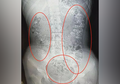 Gadis Ini Mengeluh Sakit Perut Setelah Minum Bubble Tea, Tak Disangka Ini yang Ditemukan Dokter!