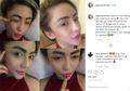 Berita Kesehatan Popular: Regina Mantan Farhat Abas Rela Sakit Untuk Perubahan Wajah, Hingga Suntik Live Cell Treatments Seharga Rp 281 Juta Dilakukan Raul Lemos