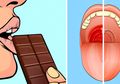 6 Trik Mengatasi Berbagai Rasa Sakit Jika Tak Ada Obat, Termasuk Makan Cokelat