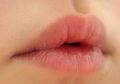 9 Perubahan Kecil pada Tubuh Ini Bisa Jadi Tanda Awal Masalah Kesehatan, Salah Satunya Bibir Pecah-pecah