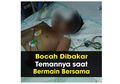 Bocah 10 Tahun Dibakar Temannya karena Dendam: Ayo, Ajari Anak untuk Meminta Maaf Agar Mereka Tak Tumbuh Jadi Pendendam