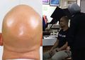 Kocak! Gara-gara Terlalu Mengilat, Kepala Botak Pria Ini Sampai Harus Ditutupi Petugas Saat Foto Paspor