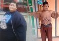 Akan Lakukan Operasi Gelambir Kulit, Mantan 'Bocah Raksasa' Aria Permana Harus Perhatikan Hal Ini
