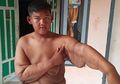 Kehilangan 105 Kg Bobot Tubuhnya, Aria Permana si Bocah Raksasa Tak Lagi Makan Mi Instan dan Minuman Kemasan