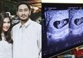 Syahnaz Sadiqah Hamil Bayi Kembar: Ini 5 Faktor yang Paling Berpengaruh dalam Mendapatkan Bayi Kembar