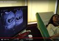 Syahnaz Sadiqah Hamil Bayi Kembar: Ibu yang Lahirkan Bayi Kembar Mungkin Lebih Panjang Umur dari Ibu-Ibu Kebanyakan