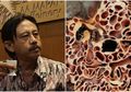 Sarang Semut dari Papua Membuat Epy Kusnandar Lolos dari Vonis Kematian Karena Kanker Otak