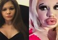 Ingin Mirip Boneka Barbie, Mahasiswa Cantik Ini Lakukan Operasi Plastik, Tapi Hasilnya Malahan Membuatnya dapat Julukan Ini