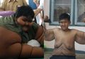Arya Permana akan Jalani Operasi Pengangkatan Gelambir, Ini Operasi Baratrik yang Berhasil Turunkan Berat Badannya dari 192 Kg Jadi 85 Kg