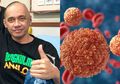 Kanker Otak Rengut Nyawa Agung Hercules, Inilah Gejala Tak Kasat Mata Penyakit Kanker Otak