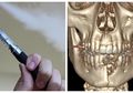 Rahang Seorang Remaja Rusak Setelah Vape yang Digunakannya Meledak di Mulut
