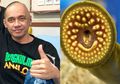 Agung Hercules Idap Kanker Otak: Peneliti Temukan Ikan Parasit yang Bisa Bantu Lawan Kanker Otak dan Stroke