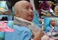 Jasad Mendiang Yana Zein Dibersihkan dengan Deterjen oleh Sang Ayah, Ternyata Ini Manfaat Formalin untuk Mayat