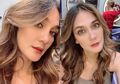 Tanpa Jaim, Luna Maya Unggah Potret Wajahnya yang Ada Flek Hitam, Tetap Banjir Pujian dari Netizen!