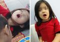Gigit Tanaman Hias yang Biasa Ada di Kebanyakan Rumah, Bocah Ini Alami Kejang dan Nggak Bisa Menutup Mulut