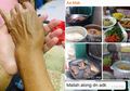 Meski Pergelangan Tangannya Patah Ibu Ini Semringah Masak di Hari Raya, Namun Kerabatnya Tak Satupun Datang