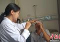Seorang Pria Mengeluh Sering Sakit Kepala, Dokter Temukan Potongan Kayu Tersangkut di Otaknya