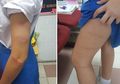 Ngamuk Dibilang Banci, Oknum Guru Ini Pukuli Siswinya Berulang Kali