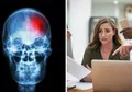 Gila Kerja Sampai 10 Jam Sehari? Waspada, Stroke Bisa Menyerang di Masa Tua