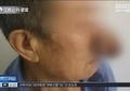 Hidung Terus Tumbuh Seperti Pinokio, Dokter Mengungkapkan Kebiasaan Ini Menjadi Penyebabnya