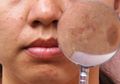 Aman Bagi Ibu Hamil, 5 Bahan Ini Ampuh Hilangkan Bercak Kecokelatan