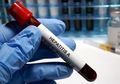 Ratusan Warga Pacitan Terserang Hepatitis A, Ini Kronologinya