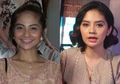 Ada Perubahan Drastis Pada Wajahnya, Tiwi Eks T2 Akui Lakukan Operasi