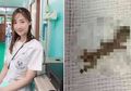 Baru Sehari Bekerja, Dokter Cantik Ini Terkejut Saat Temukan Makhluk Tak Biasa Tinggal di Telinga Pasiennya