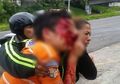 Protes Warga Kekurangan Bahan Bakar Padahal Negara Kaya Minyak, Remaja 16 Tahun Buta Setelah Terima Peluru di Matanya