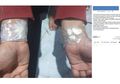 Benarkah dengan Menempelkan Bawang Putih Pada Tangan Bisa Sembuhkan Sakit Gigi?