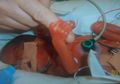Dokter Pasrah dan Angkat Tangan Untuk Selamatkan Bayi Ini, Saat Semua Orang Menyerah, Hal Ajaib Justru Terjadi