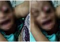 Bola Mata Seorang Anak Menyembul Keluar Setelah Ditampar Terlalu Keras oleh Ayahnya